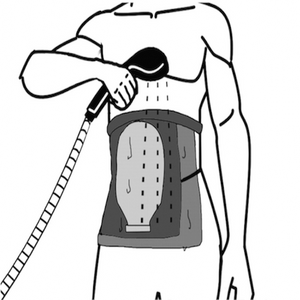 Ostomy Shower Guard designed as a unisex product, made of durable TPU material. The Shower Guard will prevent 98 percent of the ostomy bag, the skin barrier from getting soaking wet.